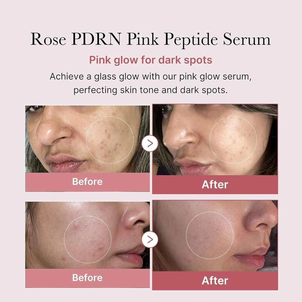 medicube PDRN Pink Peptide Serum 30ml / 1.01 oz– SALMON DNA For Anti-Aging Care